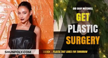 Shay Mitchell's Transformation: Plastic Surgery Rumors Explored and Debunked