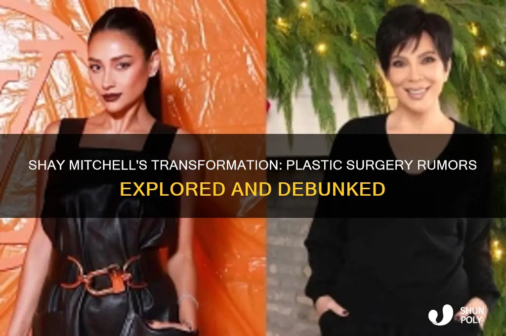 did shay mitchell get plastic surgery