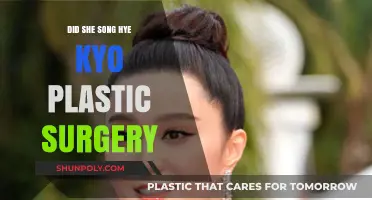 Song Hye Kyo Plastic Surgery: Unraveling the Truth Behind the Rumors