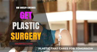 Shelby Chesnes Plastic Surgery: Fact-Checking the Transformation Rumors