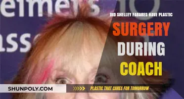 Shelley Fabares' Plastic Surgery Speculations During 'Coach' Era