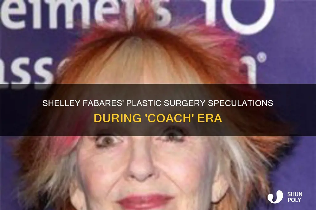 did shelley fabares have plastic surgery during coach