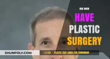Did Sher Undergo Plastic Surgery? Unveiling the Truth Behind the Rumors