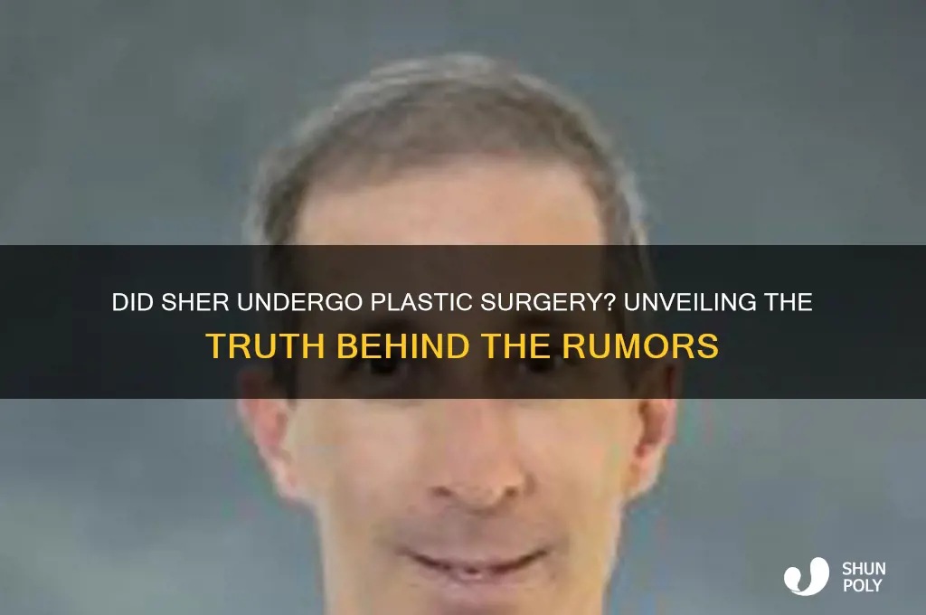 did sher have plastic surgery