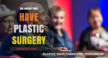 Sherry Yard Plastic Surgery: Fact-Checking the Rumors and Speculations