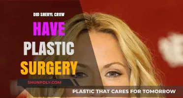 Sheryl Crow's Transformation: Plastic Surgery Rumors and Reality Revealed