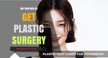 Shin Min Ah's Transformation: Plastic Surgery Rumors Explored