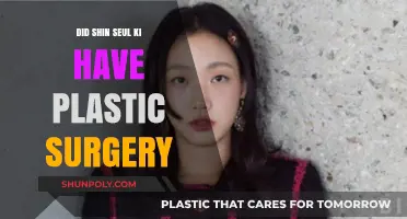 Shin Seul Ki's Transformation: Plastic Surgery Rumors Explored