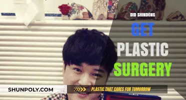 Shindong's Transformation: Plastic Surgery Rumors and the Truth Revealed