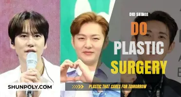 SHINee's Transformation: Plastic Surgery Rumors and Realities Explored