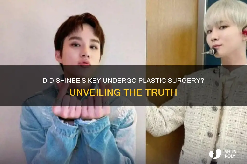 did shinee key get plastic surgery
