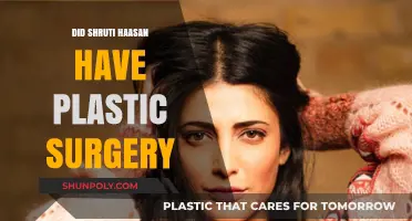 Shruti Haasan Plastic Surgery: Fact-Checking the Transformation Rumors