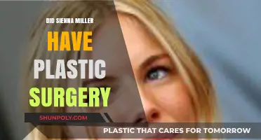 Sienna Miller Plastic Surgery: Fact-Checking the Rumors and Speculations