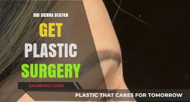 Did Sierra Deaton Undergo Plastic Surgery? Unveiling the Truth