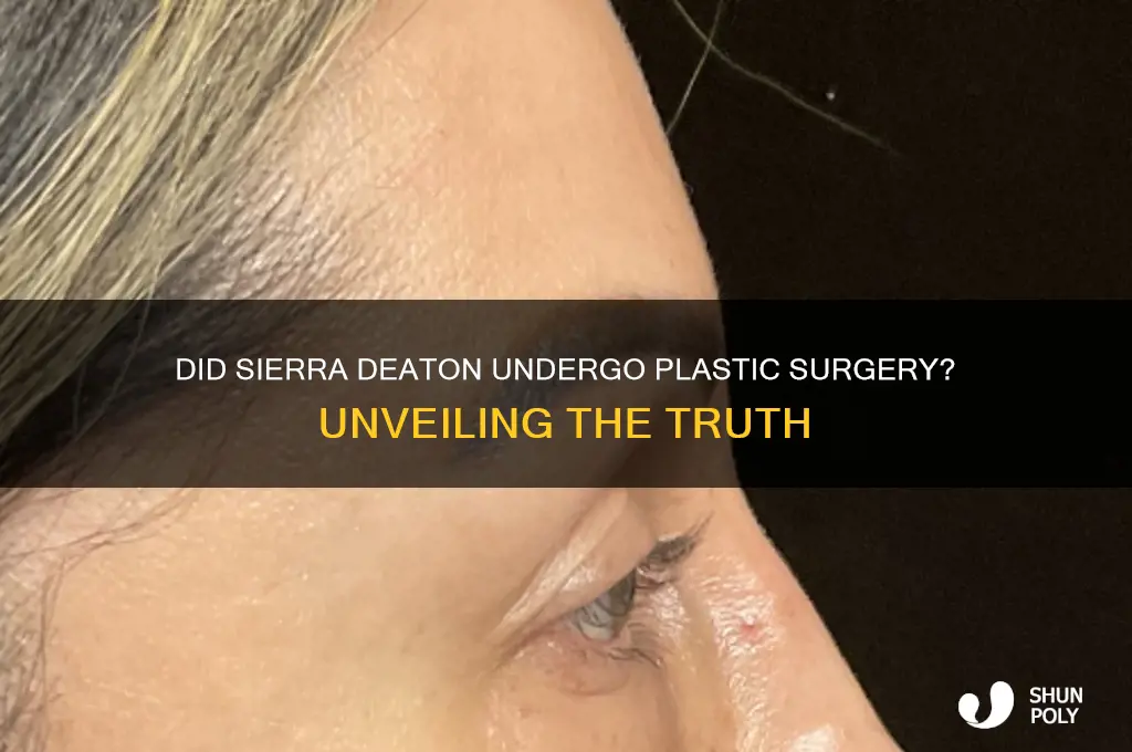 did sierra deaton get plastic surgery