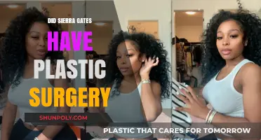 Sierra Gates Plastic Surgery: Fact-Checking the Rumors and Speculations