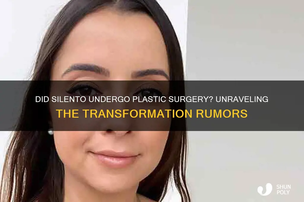 did silento get plastic surgery