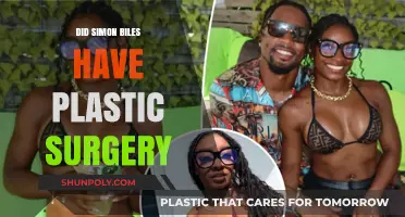 Simon Biles Plastic Surgery Rumors: Fact or Fiction?