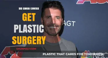 Simon Cowell's Transformation: Plastic Surgery Rumors Explored and Debunked