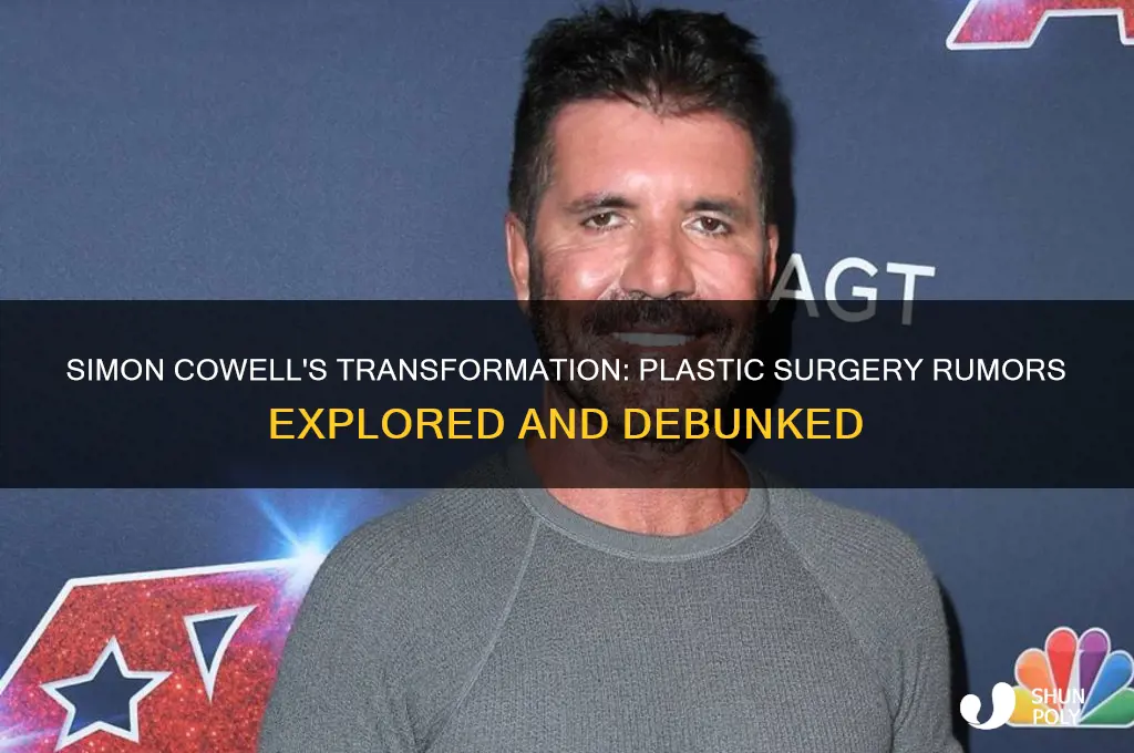 did simon cowel get plastic surgery