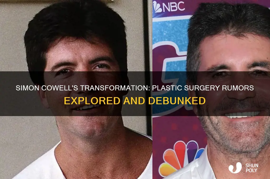 did simon cowell get plastic surgury