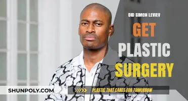 Simon Leviev's Transformation: Plastic Surgery Rumors Explored