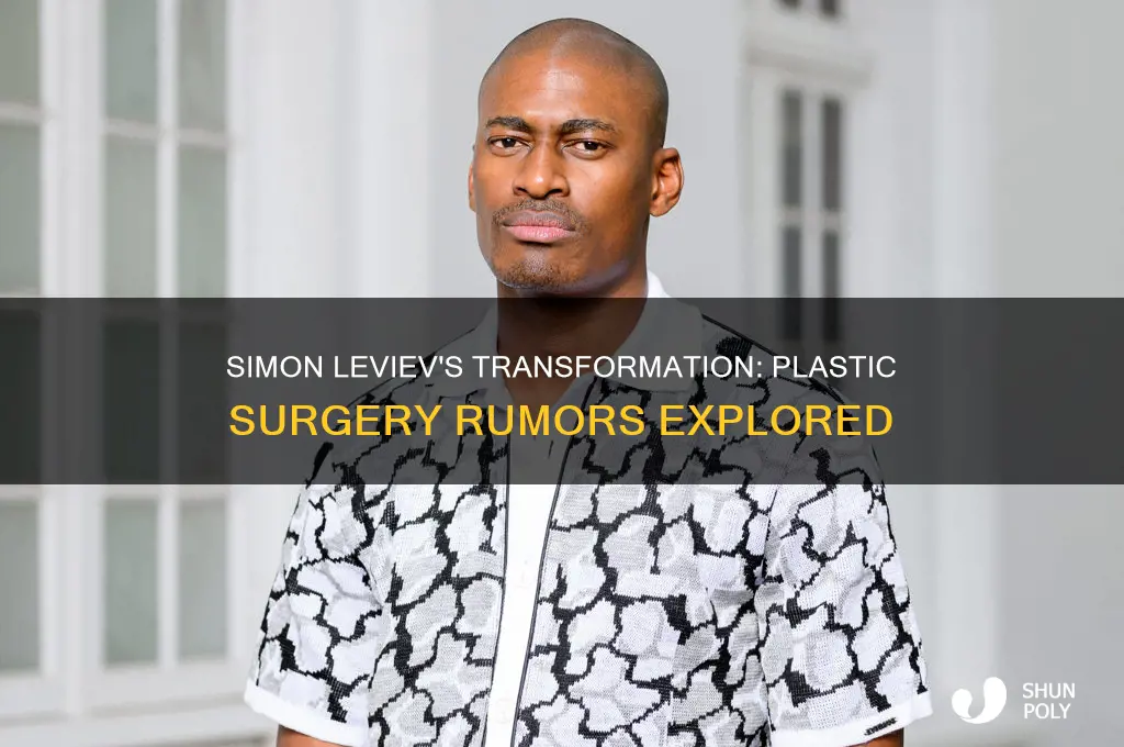 did simon leviev get plastic surgery