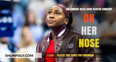 Simone Biles Nose Job: Fact-Checking Plastic Surgery Rumors