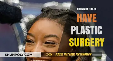 Simone Biles Plastic Surgery Rumors: Fact or Fiction?