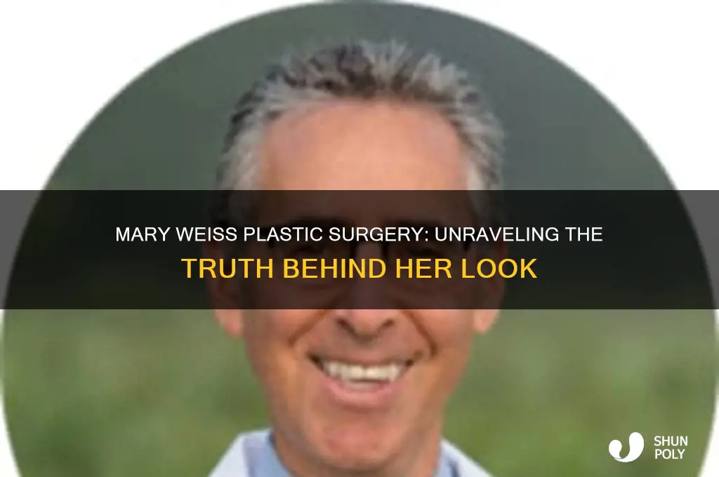 did singer mary weiss plastic surgery