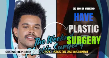 Did The Weeknd Undergo Plastic Surgery? Uncovering the Truth Behind His Look