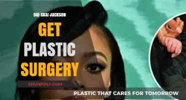 Skai Jackson Plastic Surgery Rumors: Fact or Fiction?