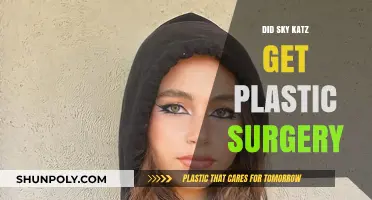 Sky Katz Plastic Surgery: Fact-Checking the Rumors and Speculations