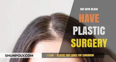 Skyh Black Plastic Surgery: Fact-Checking the Rumors and Speculations