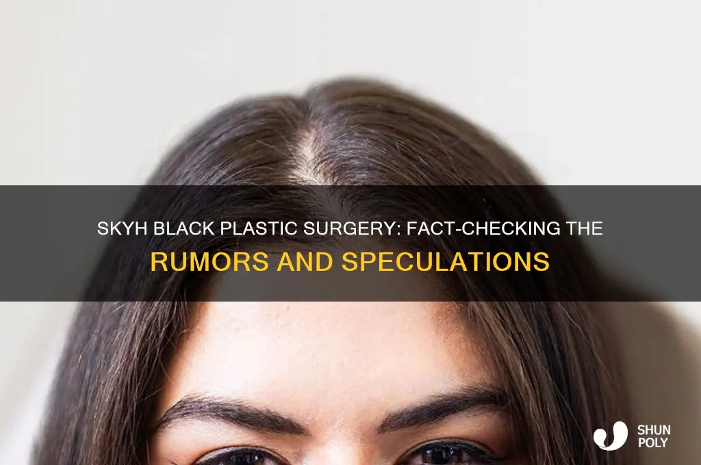 did skyh black have plastic surgery
