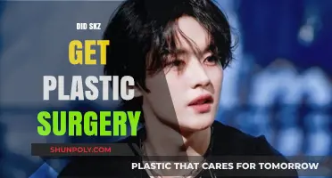 Did Stray Kids Undergo Plastic Surgery? Unveiling the Truth