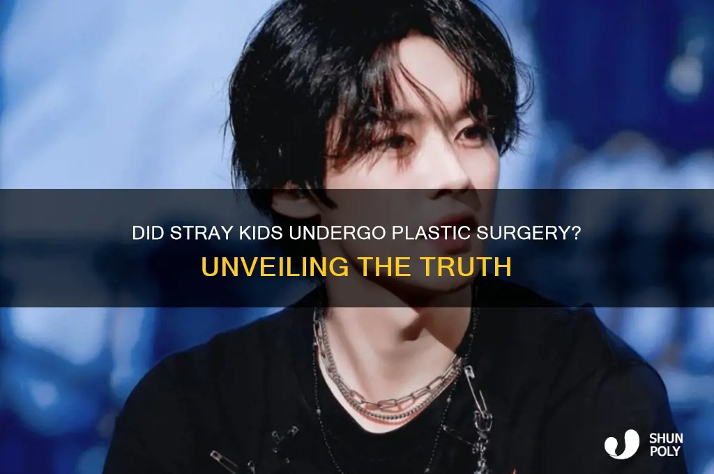 did skz get plastic surgery
