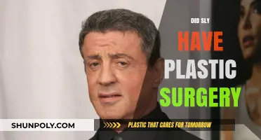 Did Sly Stallone Undergo Plastic Surgery? Unveiling the Truth