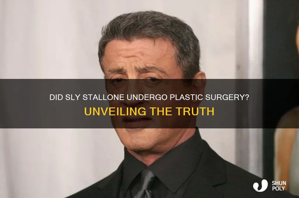 did sly have plastic surgery