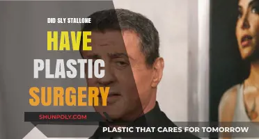 Sly Stallone's Transformation: Plastic Surgery Rumors and Reality Revealed