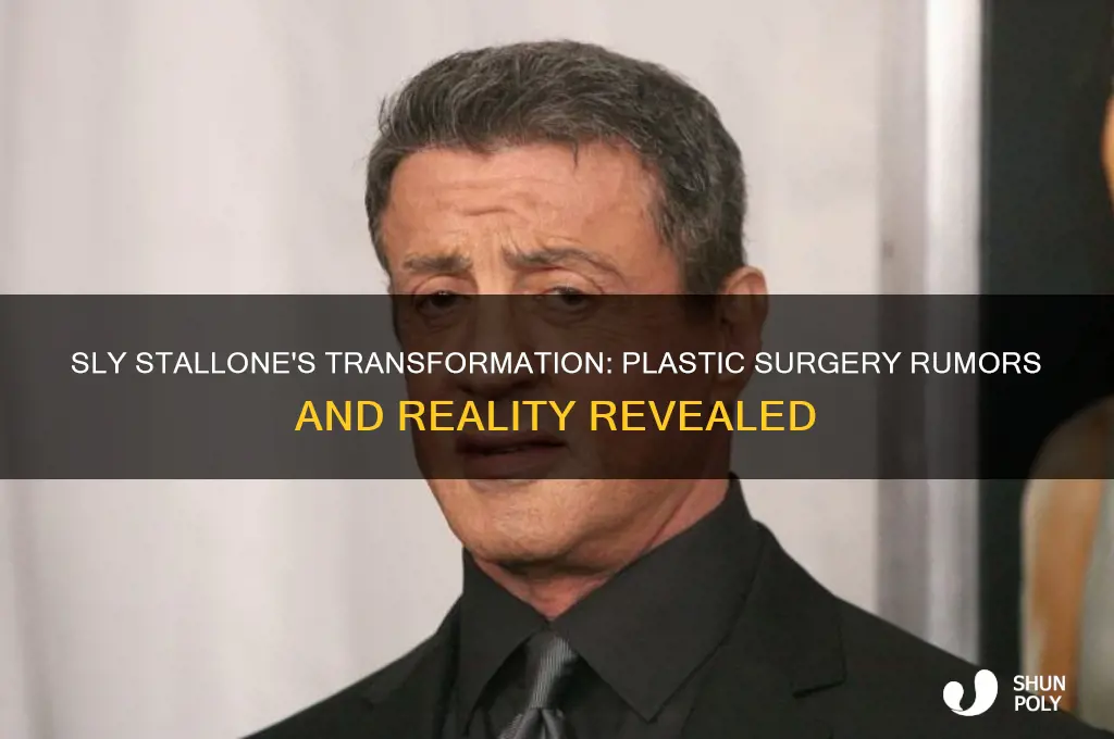 did sly stallone have plastic surgery