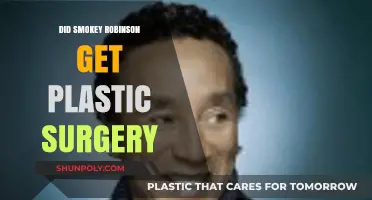Smokey Robinson's Transformation: Plastic Surgery Rumors Explored