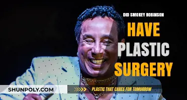Smokey Robinson's Transformation: Plastic Surgery Rumors Explored