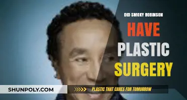Smoky Robinson's Transformation: Plastic Surgery Rumors Explored