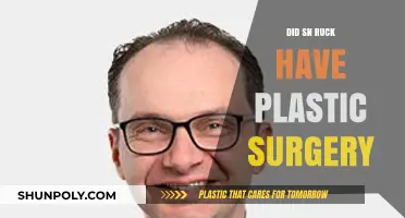 Did SN Ruck Undergo Plastic Surgery? Unveiling the Truth