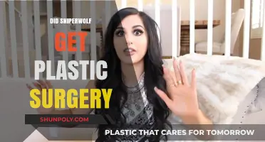 SniperWolf Plastic Surgery: Fact-Checking the Rumors and Speculations