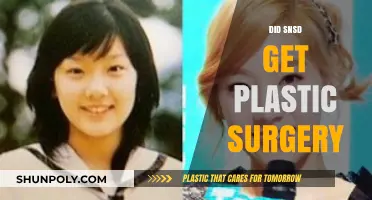 SNSD Plastic Surgery: Unveiling the Truth Behind Their Transformations