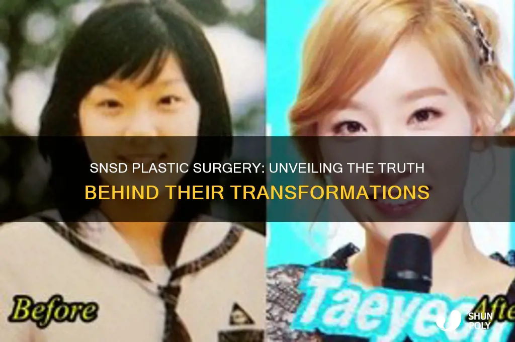did snsd get plastic surgery