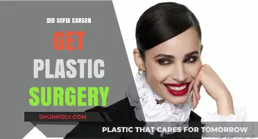 Sofia Carson's Transformation: Plastic Surgery Rumors Explored and Debunked