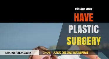 Sofia Jirau Plastic Surgery: Fact-Checking the Rumors and Speculations